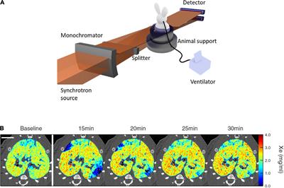 Imaging Regional Lung Structure and Function in Small Animals Using Synchrotron Radiation Phase-Contrast and K-Edge Subtraction Computed Tomography